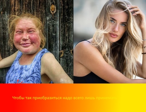 Алкоголичка отказалась от спиртного, и сейчас её преображение впечатляет