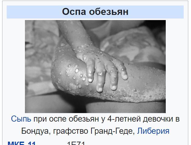 Пандемия. Коронавирус и съехавшие крыши. Россия и мир. Часть 35