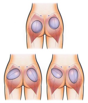 Фигуристая бразильянка Рафаэла Равена