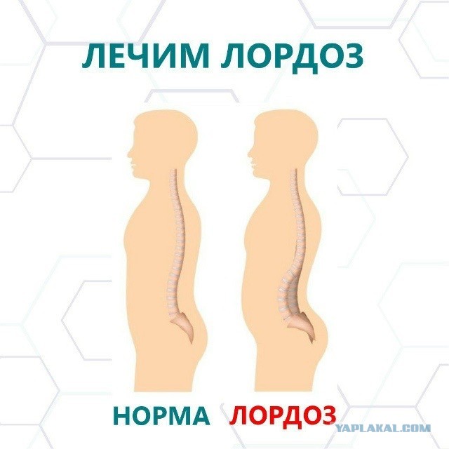 Кто такая фригидная женщина?
