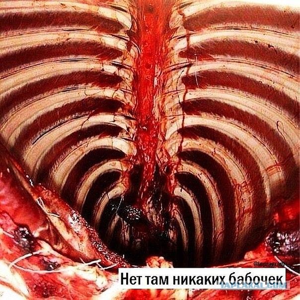 Околомедицинскую деградацию заказывали? Нет? А придётся!