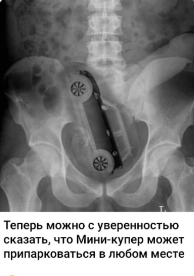 Так себе картинки 25.02.25