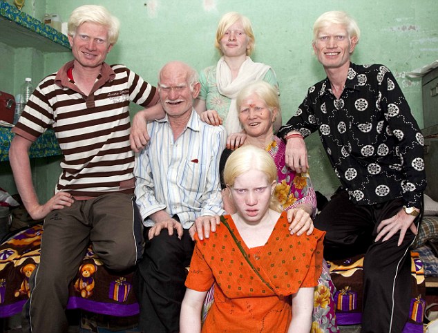 Индийская семья альбиносов