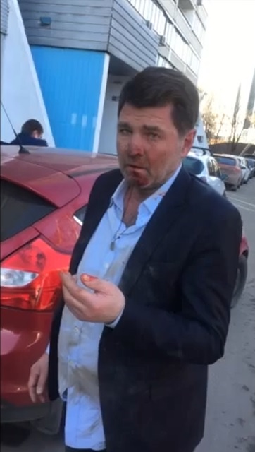 Как я машину без подголовников купил)