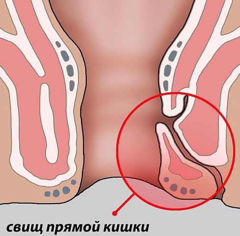 Любитель клизм и главный неряха — король Людовик XIV. К чему привело странное увлечение короля?