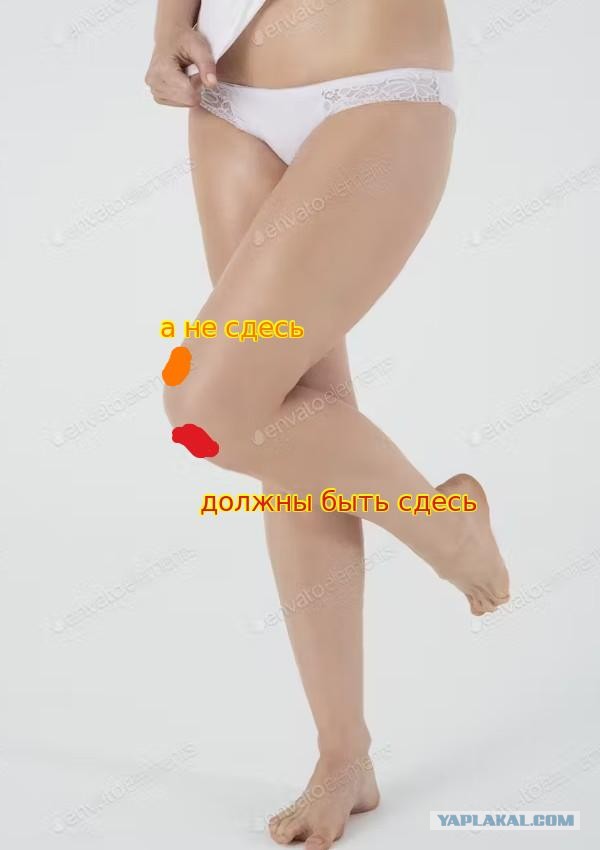 Девушки, будьте осторожны на природе, могут остаться ожоги от кружки