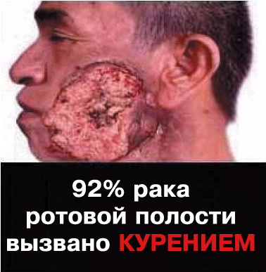 Если ты не куришь