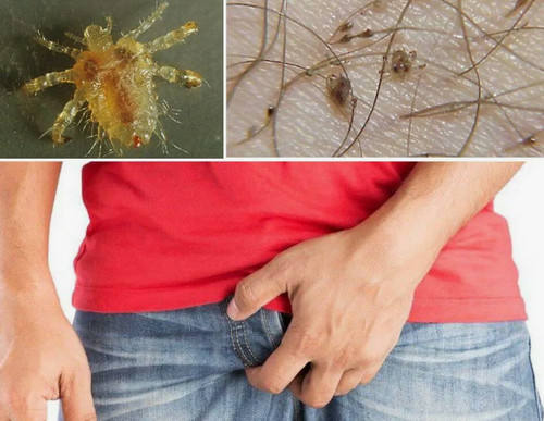 Не знаю как и быть! Как отучить мужа лазить в трусах
