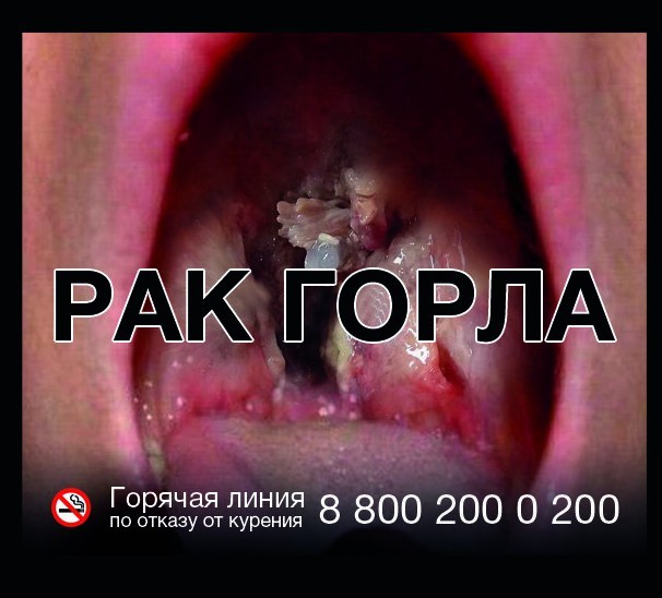На такого рака никакого пива не хватит!