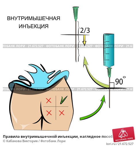 Я уколов не боюсь - если надо уколюсь !