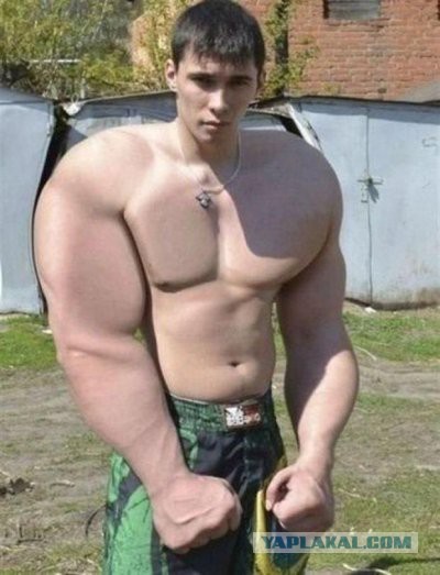 Девушка-анорексичка взялась за себя и выздоровела