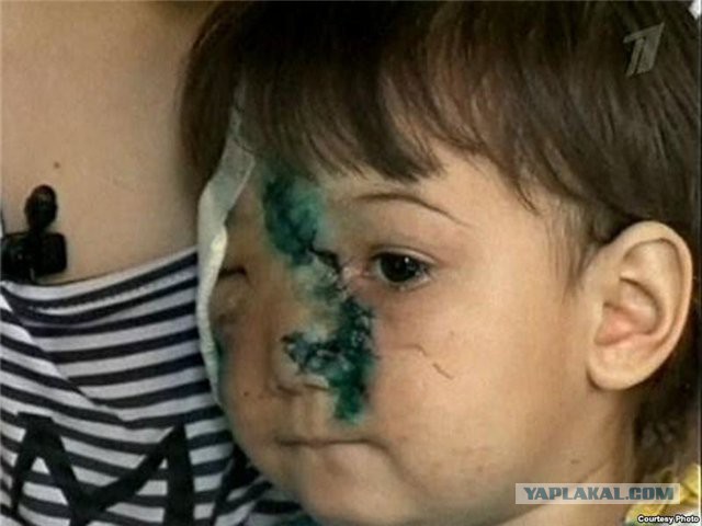 Живодер убил собаку