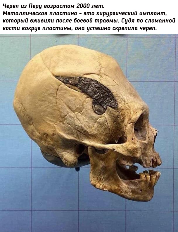 Небольшая подборка истрических фото (04.03)