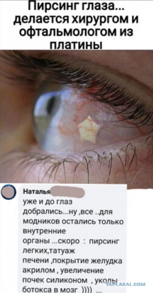 Бредзона 28.01.2021