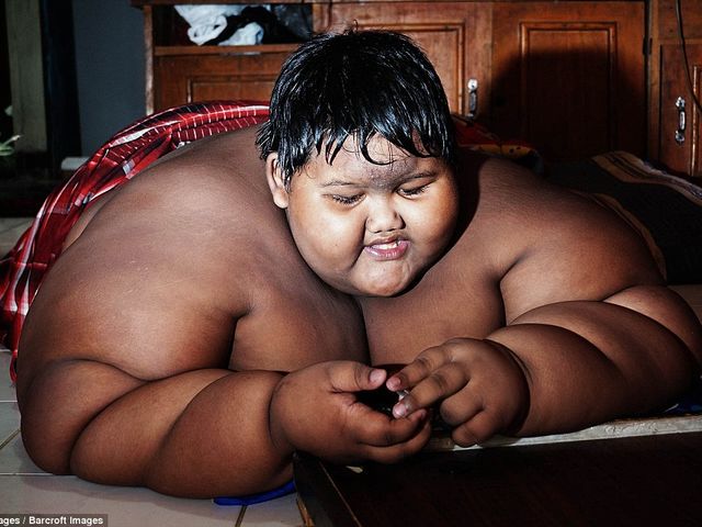 10-летнего мальчика весом 192 кг экстренно посадили на диету
