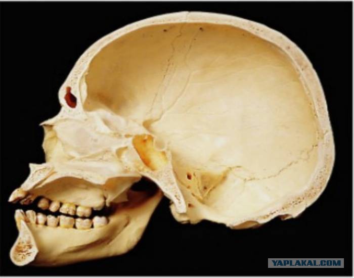 Кости черепа каждая кость. Сагиттальный распил черепа анатомия. Человеческий череп в разрезезе.