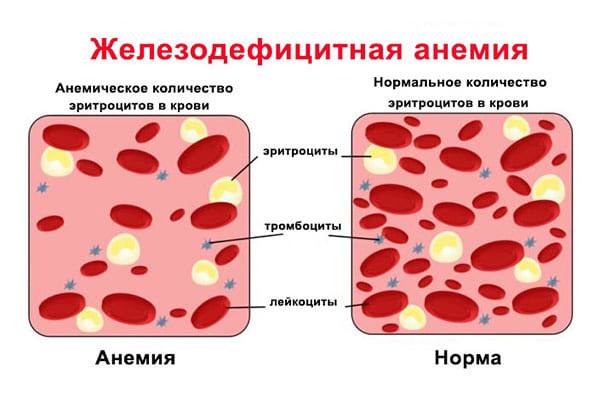 Пандемия. Коронавирус и съехавшие крыши. Россия и мир. Часть 31.