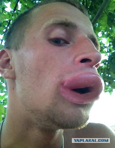 Когда друга укусила оса