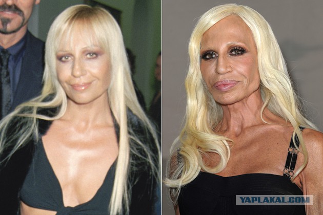 Знаменитости, которые безобразно стареют