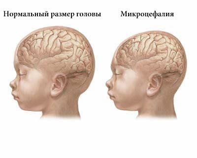 В Китае родители массово скупают шлемы, которые делают головы детей идеально круглыми