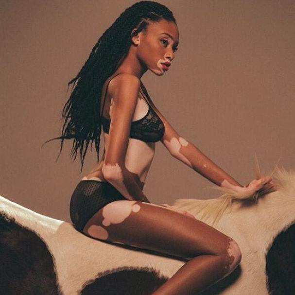 Шантель Винни