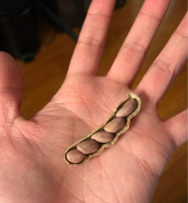 Люди, которые выиграли в «пищевую лотерею»