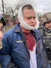 Столтенберг: Украина может атаковать военные объекты за пределами своих границ с помощью F-16.