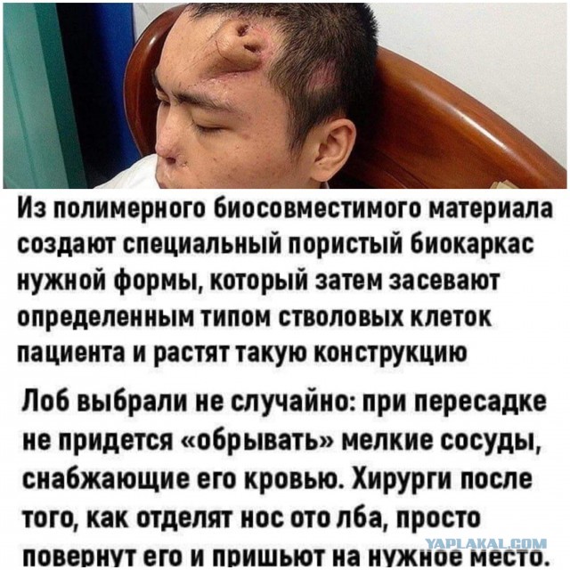 Бредзона 31.01.21