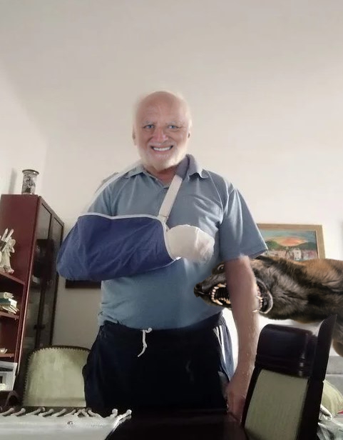 Гарольд сломал руку