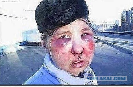 Что произошло с девушками?