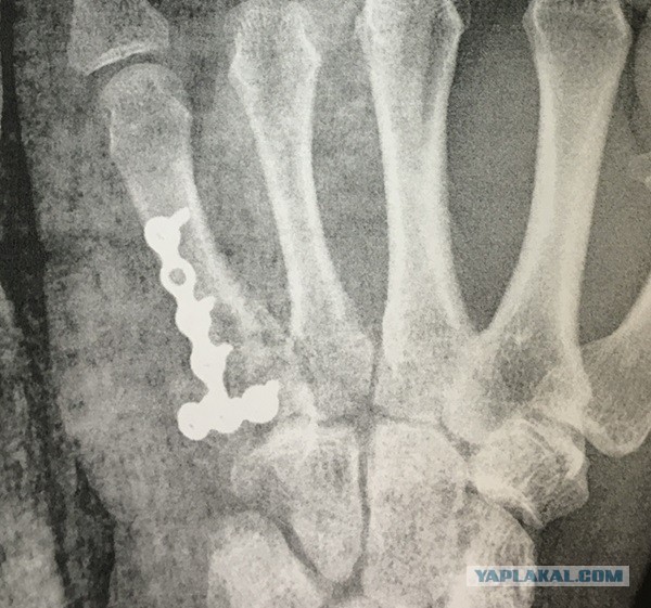 Астрологи объявили месяц без секса.