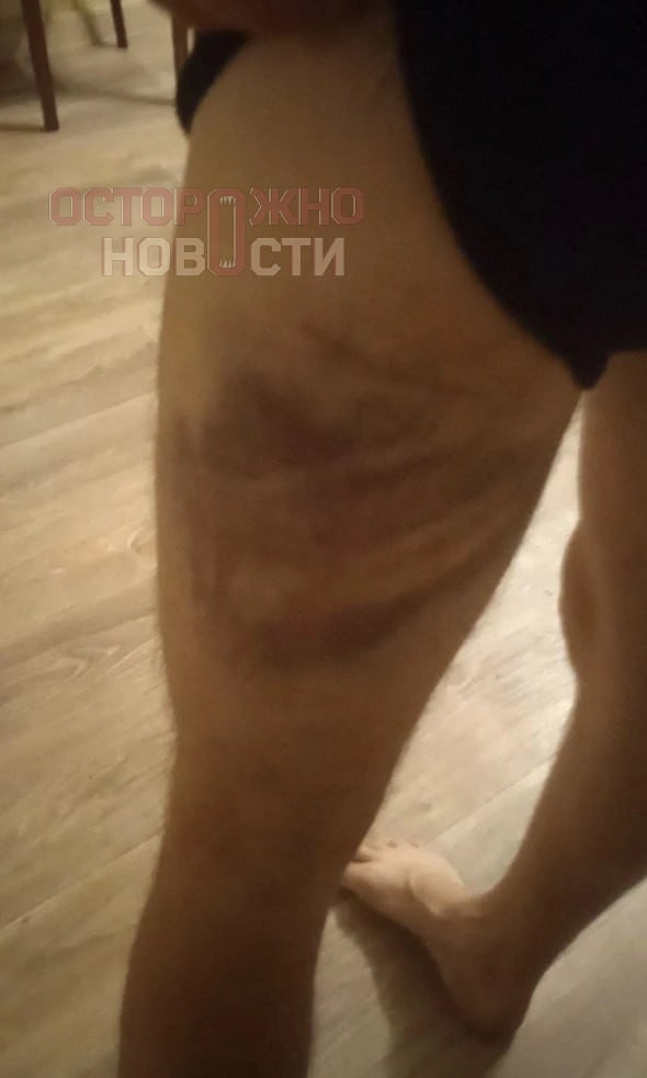 «Надели наручники и привязали к турнику. Голову обмотали скотчем, в рот засунули шапку и дубинками отбивали мышцы»