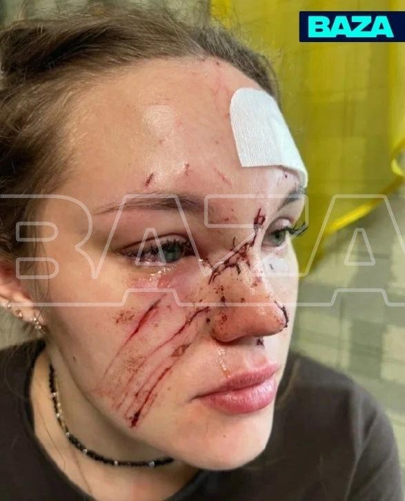 Молодую учительницу физкульутры изуродовала «розочкой» медсестра в кировском ночном клубе