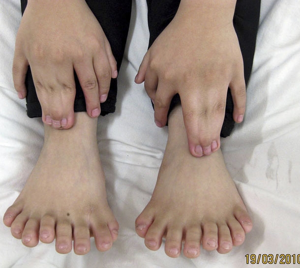 Восемь пальцев на каждой ноге