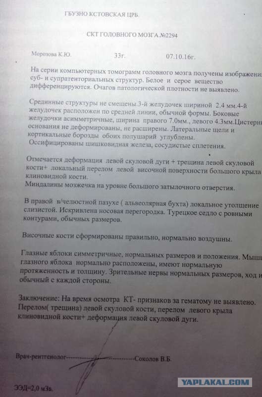 Суд назначил 5 000 рублей компенсации девушке, которой в полиции проломили кости лица