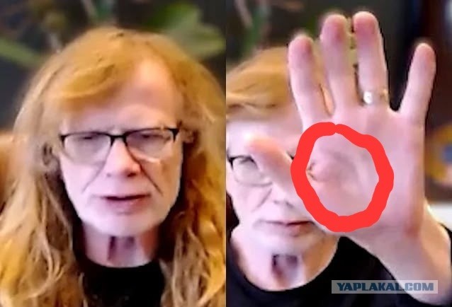 Дейв Мастейн  подробно рассказал о проблемах с руками