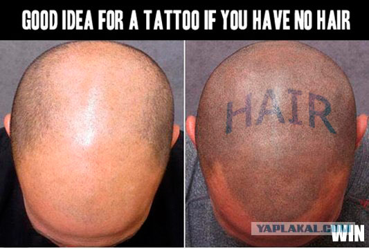 Как избавиться от лысины