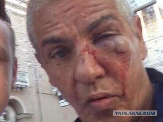 Дедушка уже, говорят даже сиделый