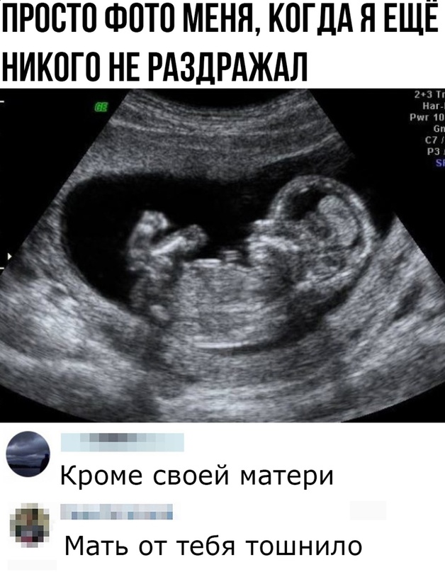 Весёлый полтишок 10.06.24