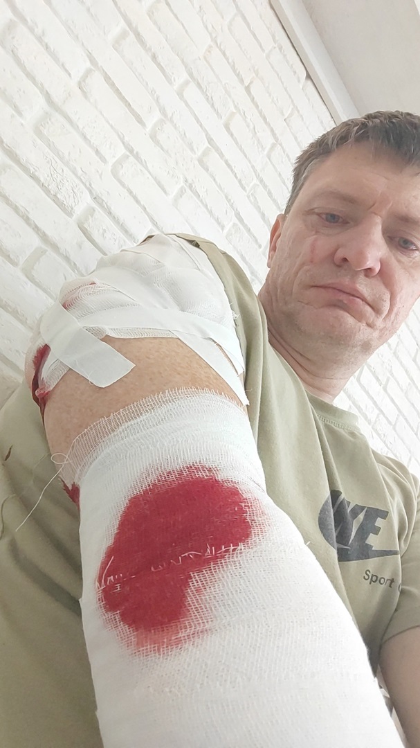 Свора дворняг и алабай напали на жителей башкирского Салавата. Мужчину от агрессивных собак спас проезжавший мимо водитель