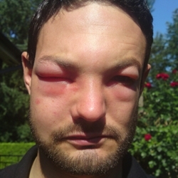 Не бойтесь шершней!