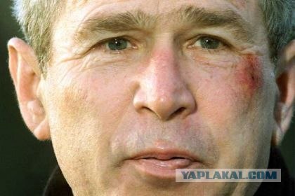 Кто поставил Путину синяк?