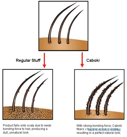 Девайс для лысеющих...