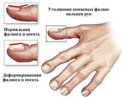 Девчонкам на радость