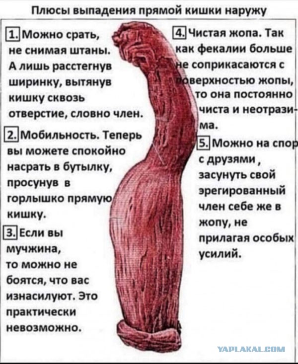 Сборка жипегов