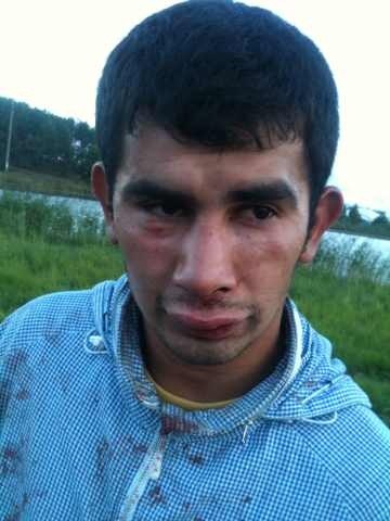 Моего друга на Селигере избили чеченцы