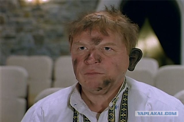 Афганской девушке Аише сделали новый нос