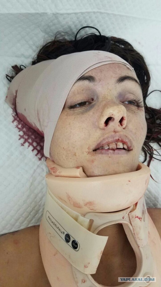 Стали известны новейшие подробности жизни и смерти голой туристки