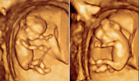 10 научных прорывов 2012 года