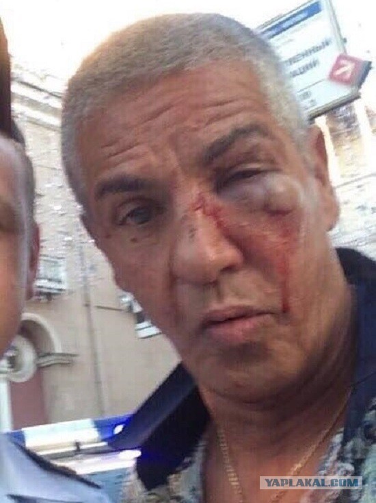 Обидчик Сэми Насери рассказывает, за что избил актёра